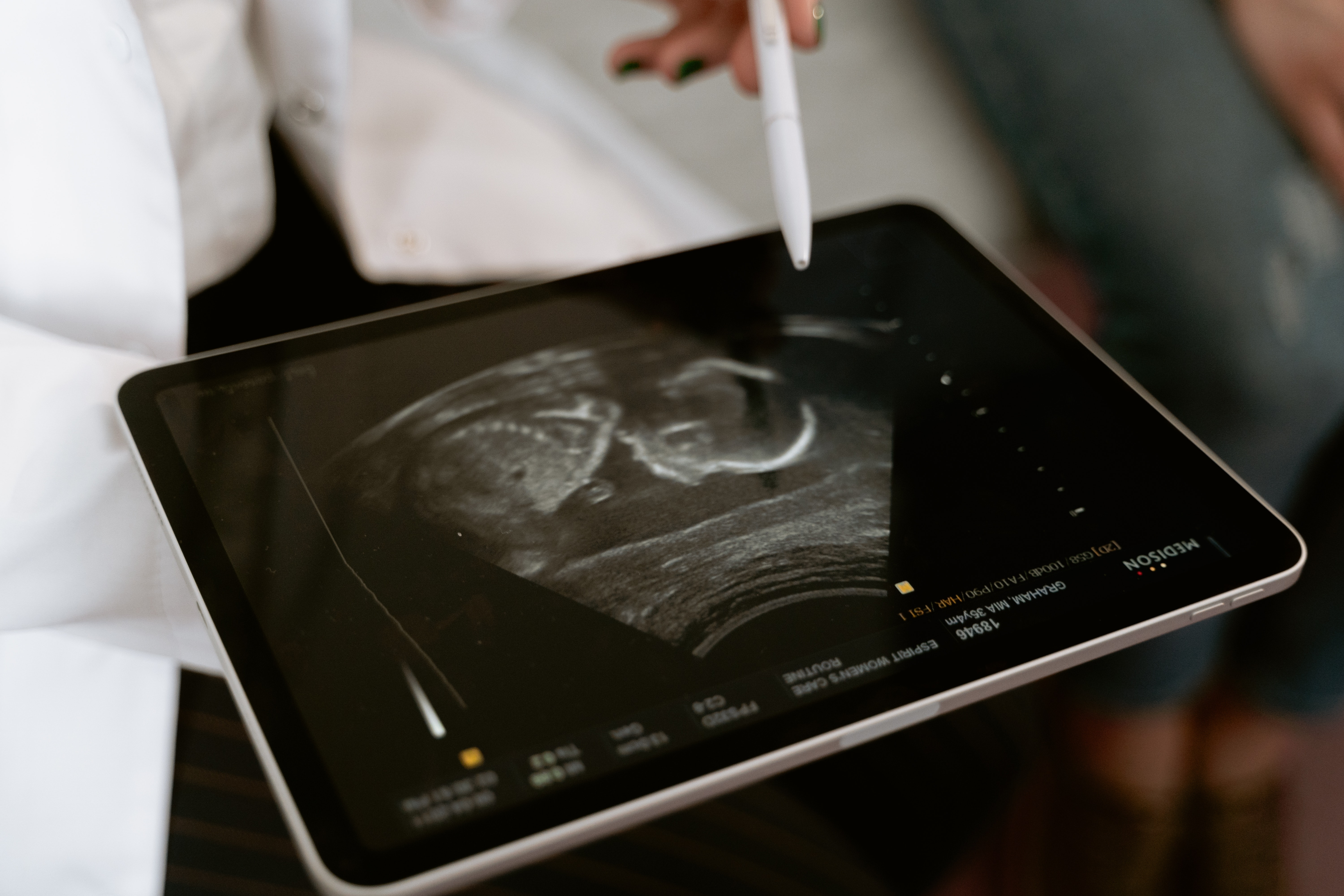 Medical professional pointing at a sonogram on a tablet screen.